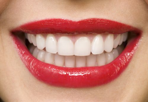 Porcelain veneers vs composite veneers: What's the difference?