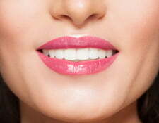 porcelain veneers