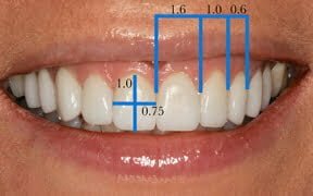 Tooth proportion